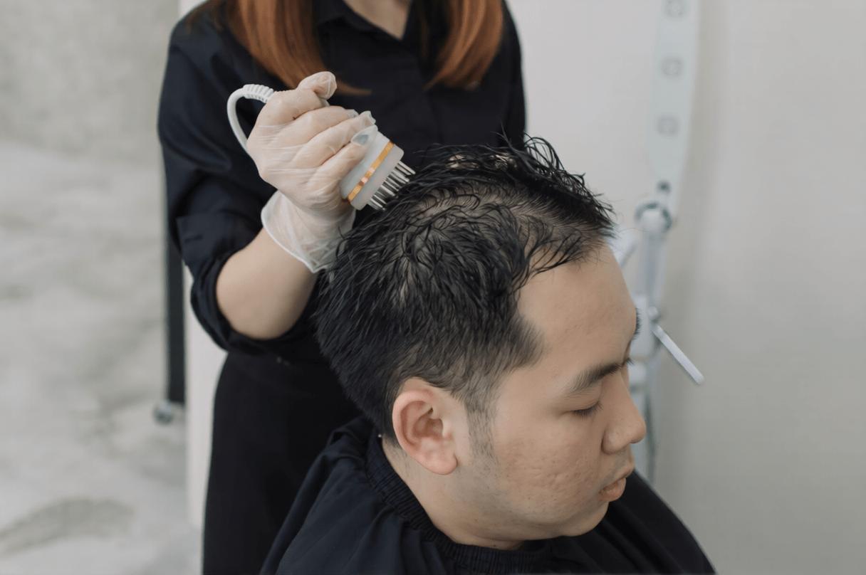 Hair Restoration-ezremove